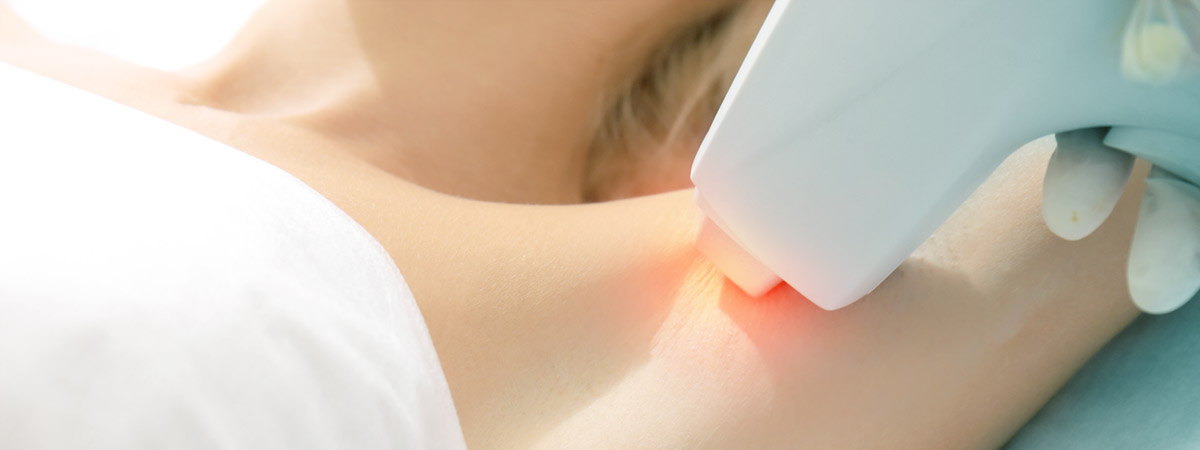 Almea, Epilazione Laser